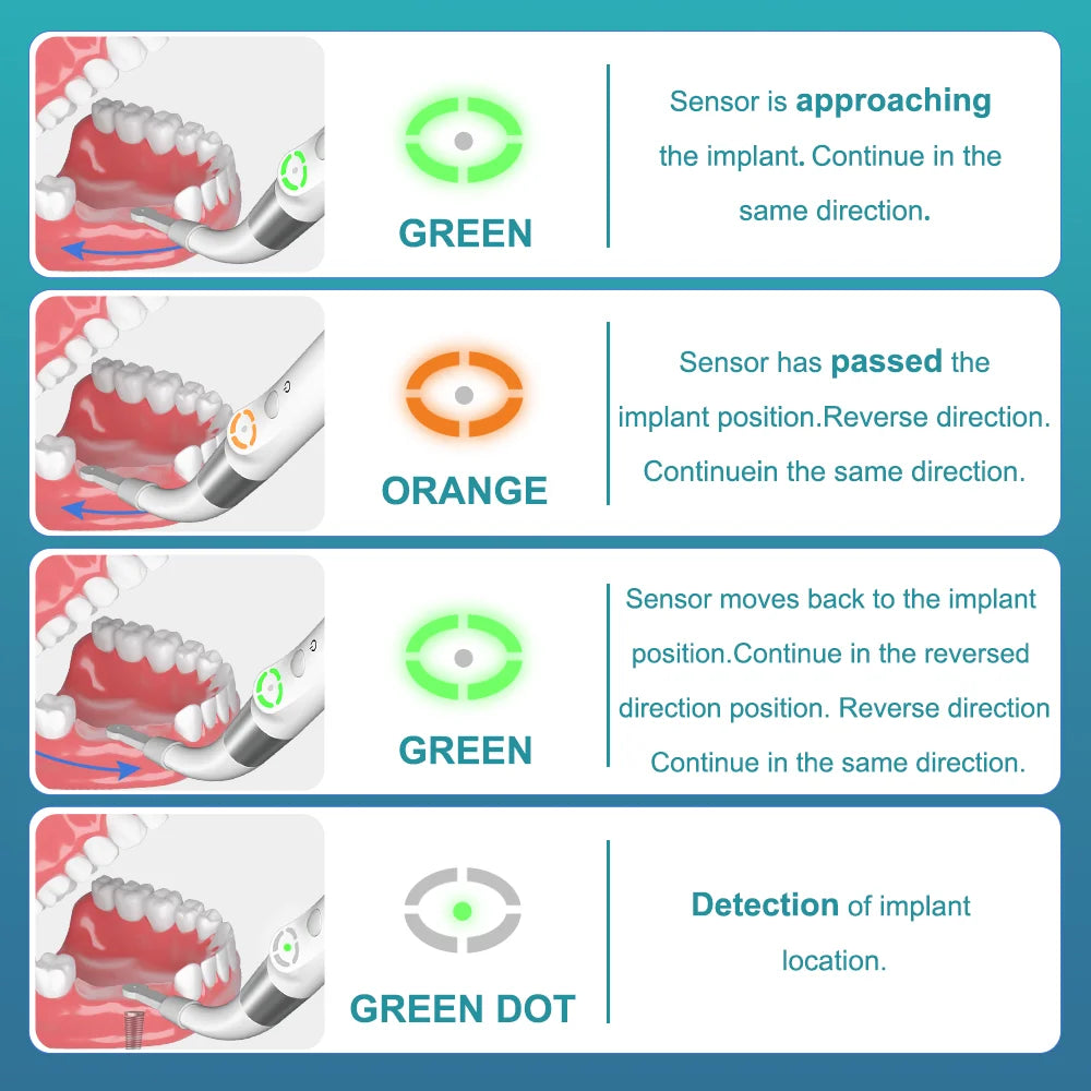 AI Dental Implant Locator Cross-Scanning Spot Screwdriver 360° Rotatable Sensor Localization Detector Tool AI-ID1 - Image 6